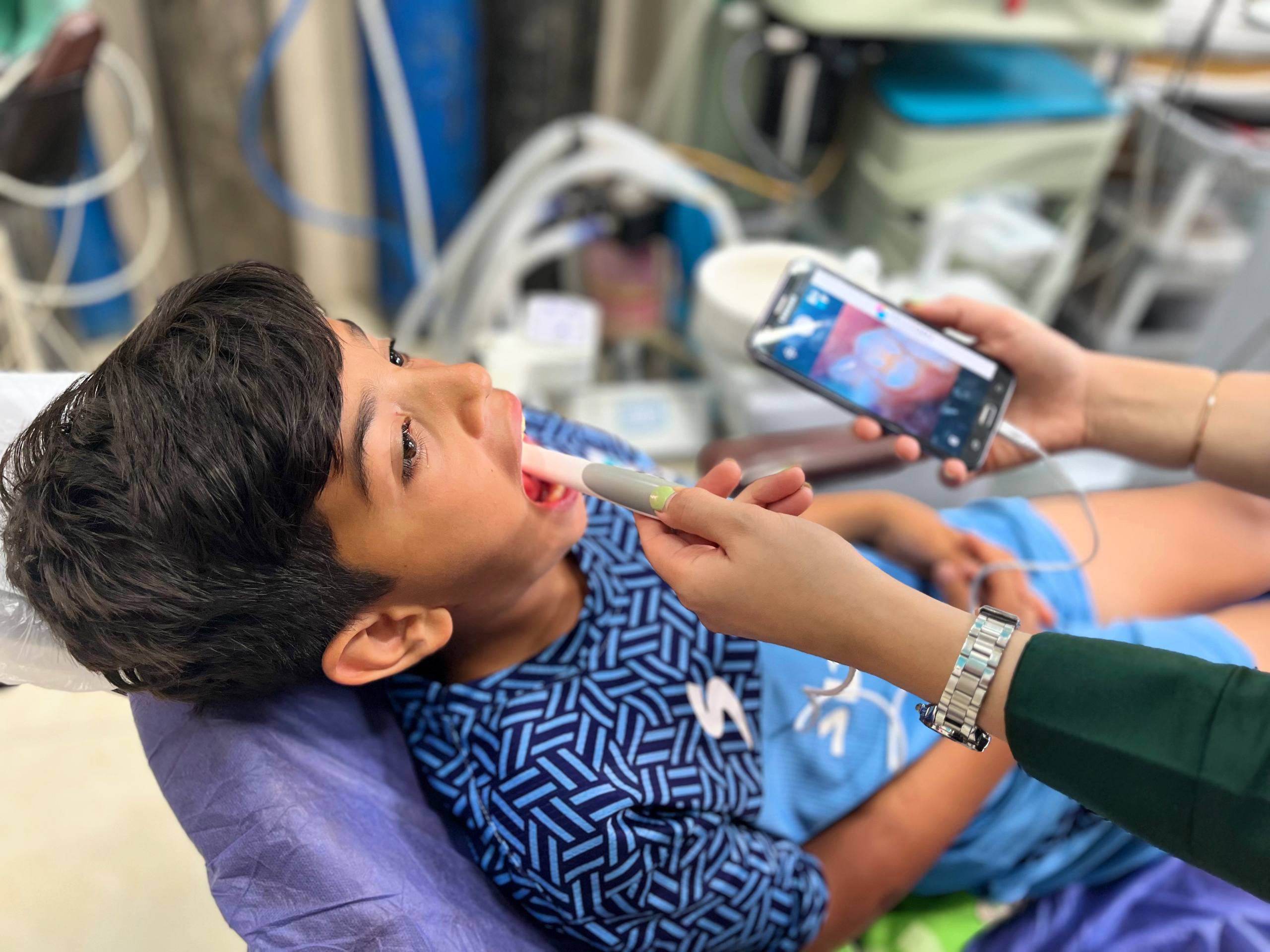 دوربین داخل دهانی