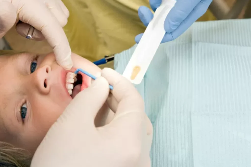 فلورایدتراپی چیست